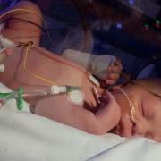 Baby Carter spent 24 hours in the Norfolk and Norwich University Hospital's NICU